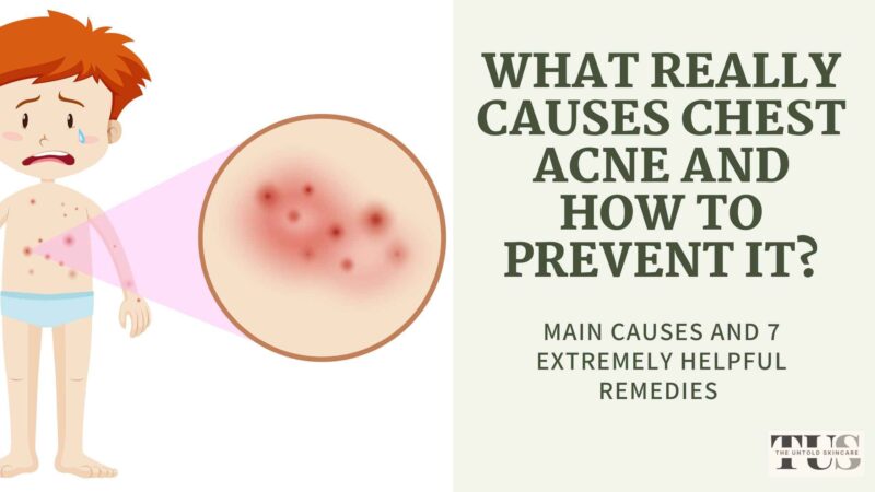 What Causes Chest Acne and How to Prevent it?