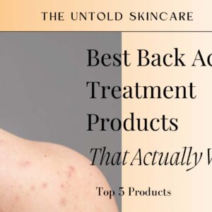 Best Back Acne Treatment Products That Actually Work: Top 5 Products