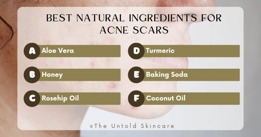 best natural home remedies for acne scars