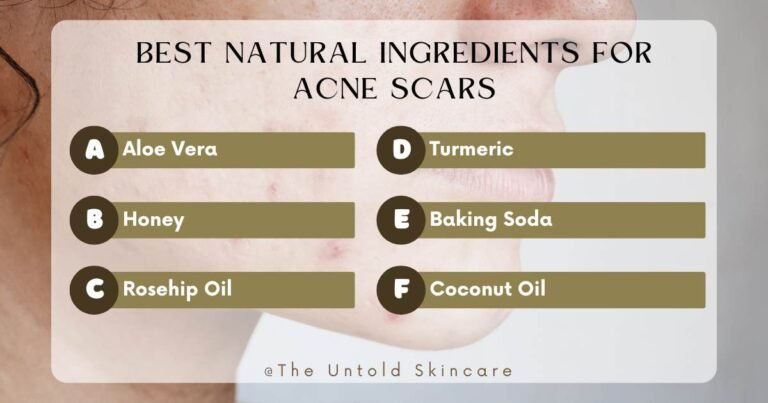 Curated visual reference: Best Natural Home Remedies For Acne Scars That Actually Work Photo Inspiration