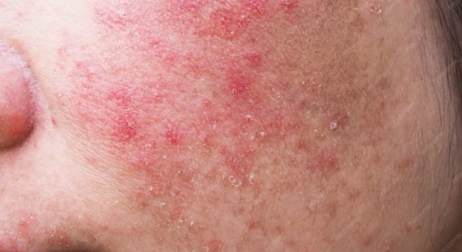 a woman with sensitive skin